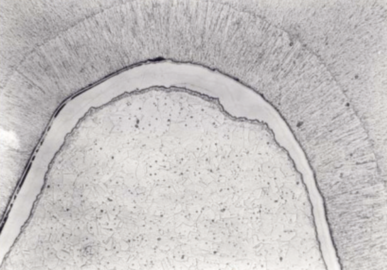 SCHILD METALLVEREDLUNG AG